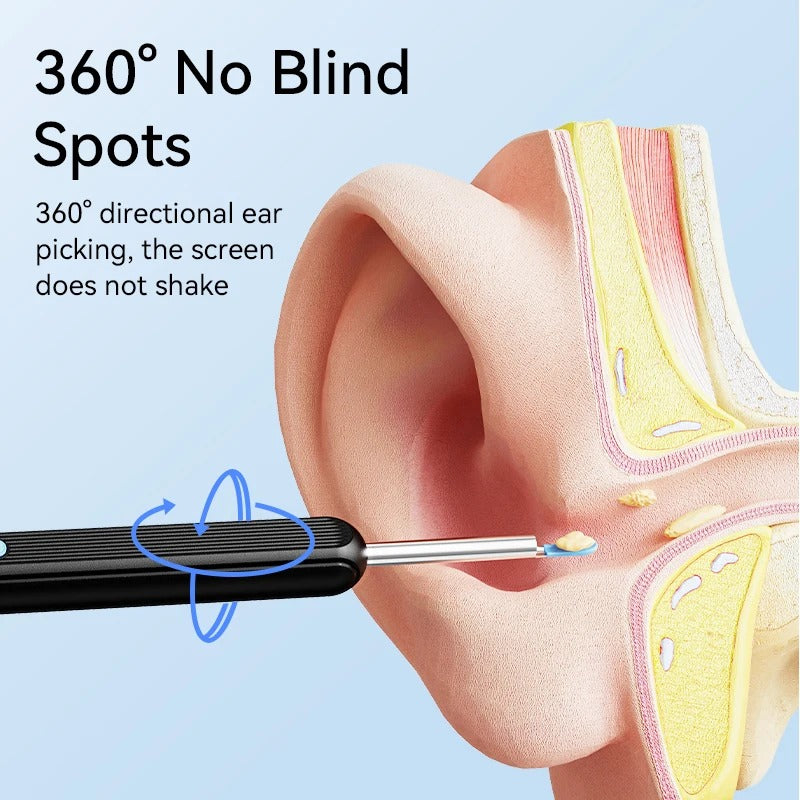 Earwax Removal Kit