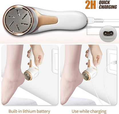 Foot Grinder| Skin Remover