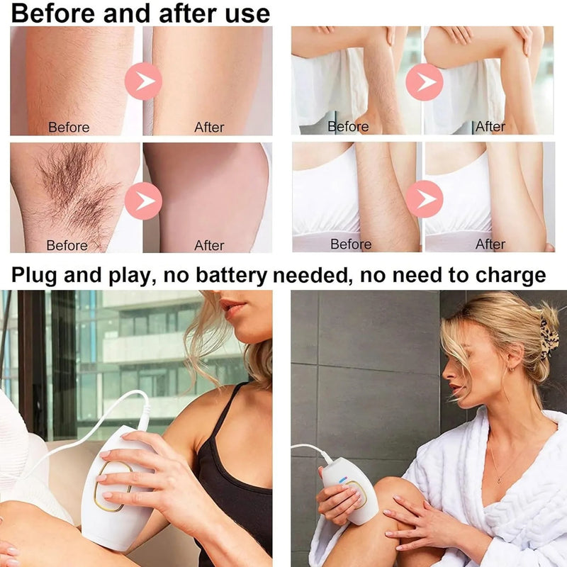 Freezing Point IPL Laser Hair Removal Device –  For Face & Body